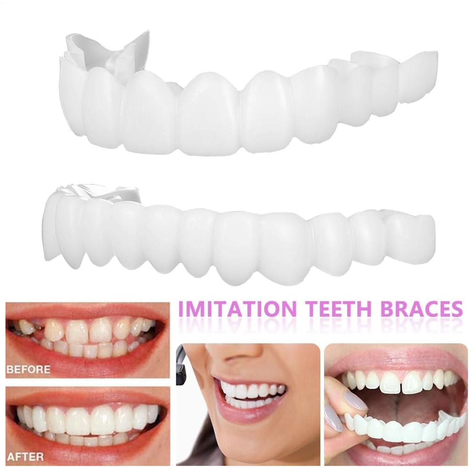 Teeth Whitening With Braces - 歯科用上下義歯カバー ブライトベニア 快適フィット フレックスデンチャー ブレース ホワイトニング交換用
