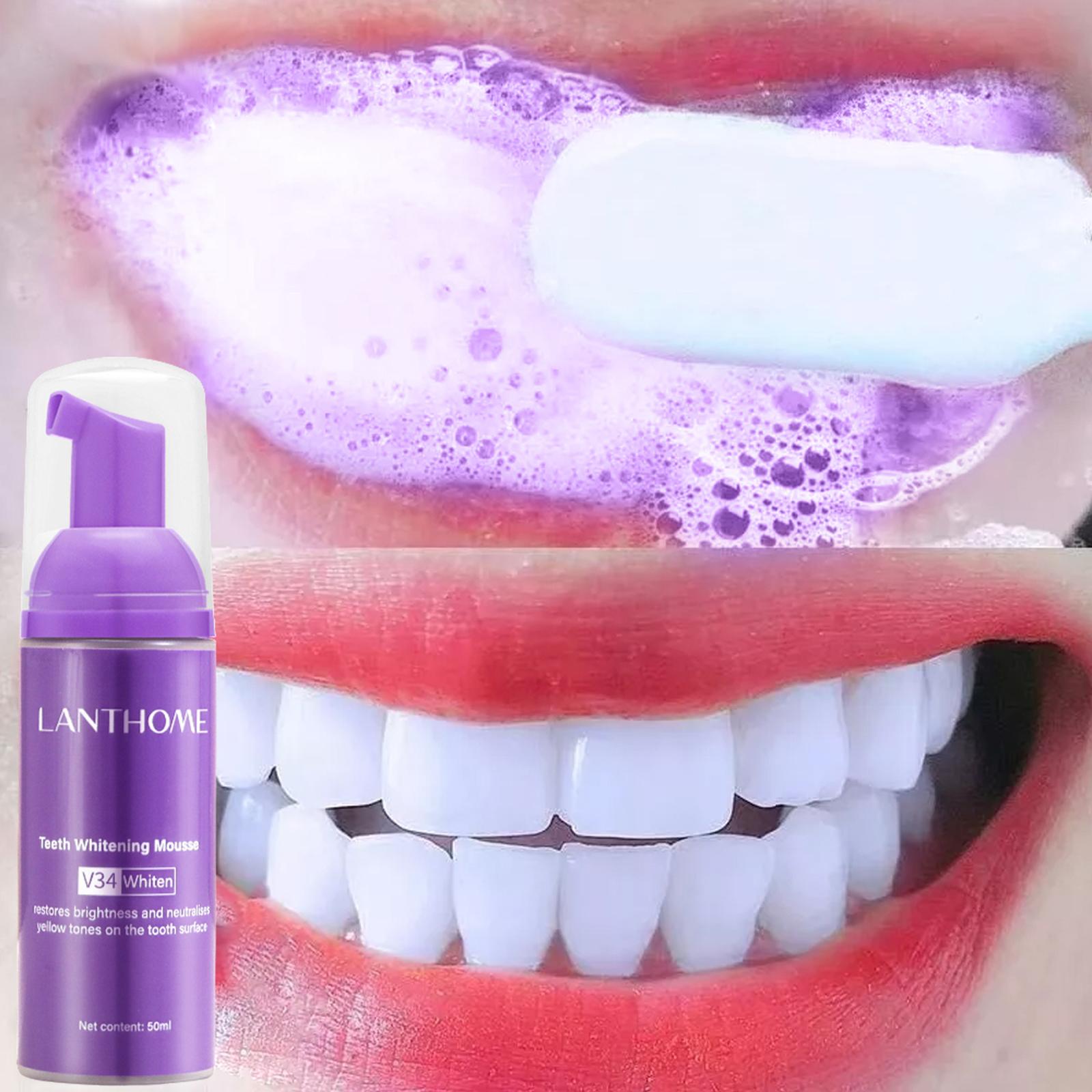 Teeth Whitening Yellow Teeth - V34 ムース歯クリーニング歯磨き粉効果的な美白歯の除去深い美白汚れ黄色口腔歯磨き粉ケア