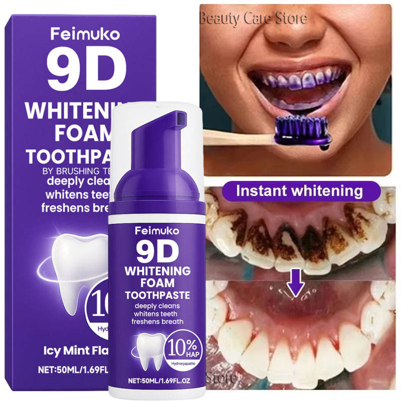 Teeth Whitening Yellow Teeth - 9D パープル歯磨き粉ムース 黄ばんだ歯の汚れ除去用集中ステインリムーバー フレッシュブレスオーラルケアガム