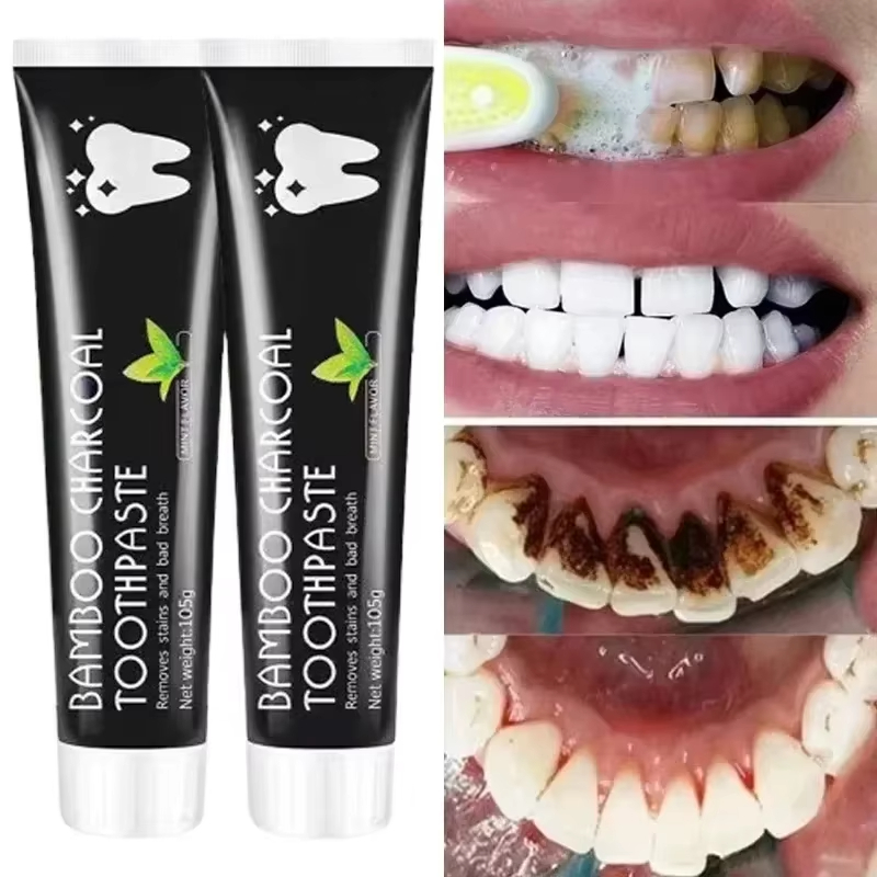Teeth Whitening Yellow Teeth - ホワイトニング歯磨き粉 竹炭歯磨き粉 口臭を吸収し、黄色い歯を除去します 強力なクリーニング 歯の汚れ オーラルケア
