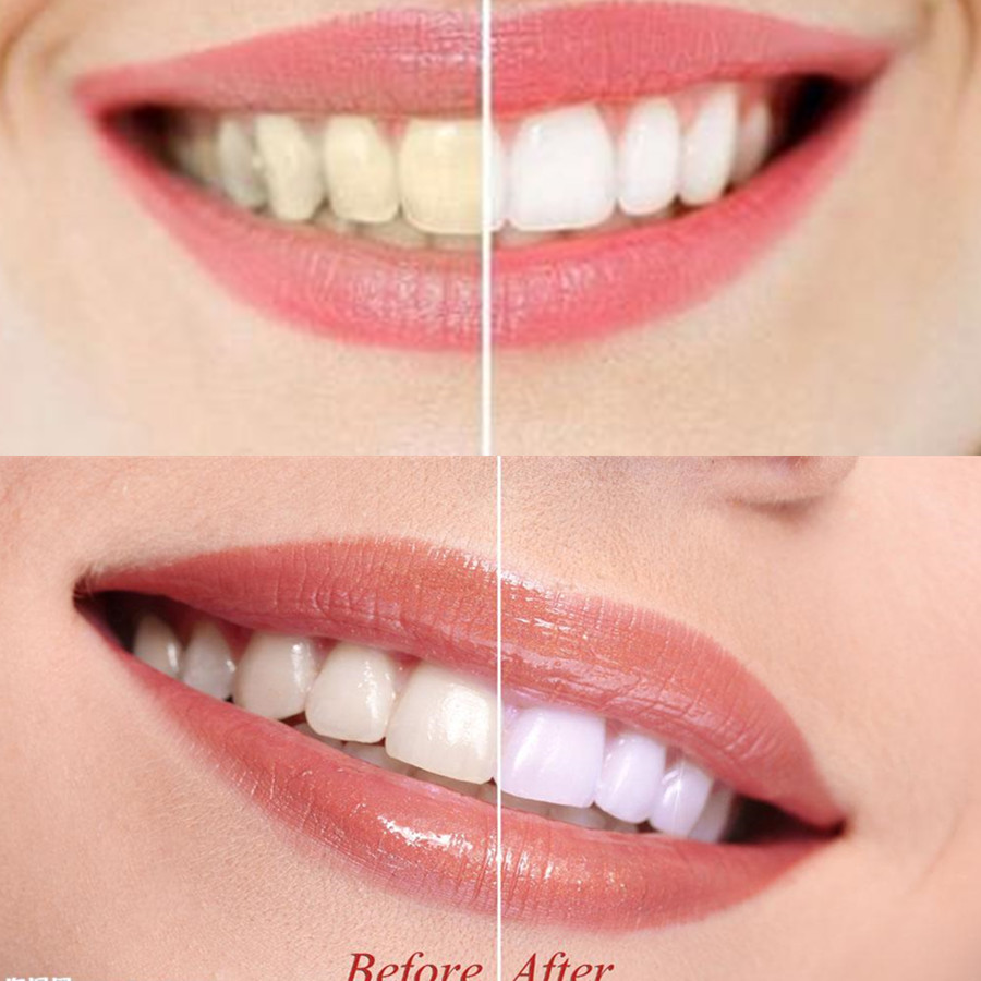 竹炭歯,口腔衛生,煙のホワイトニング,新鮮な呼吸のための歯の - Teeth Whitening Yellow Teeth のレビューと価格