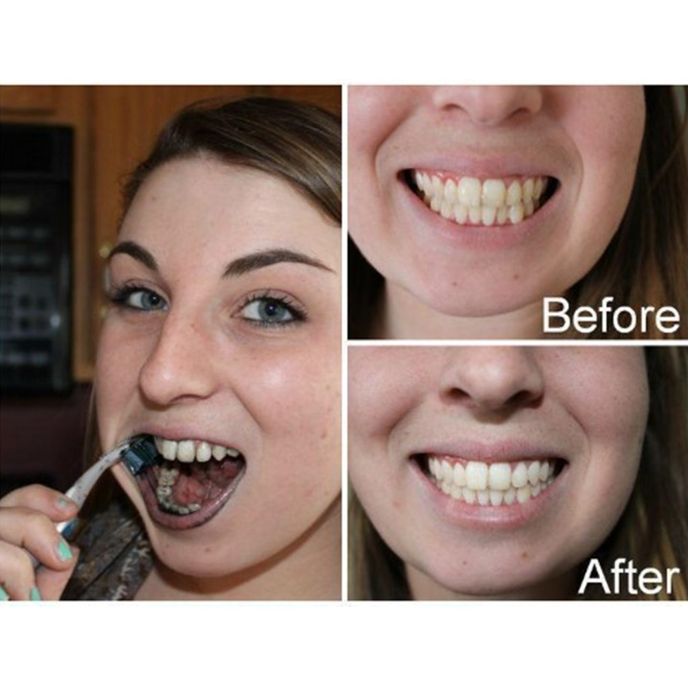 竹炭歯,口腔衛生,煙のホワイトニング,新鮮な呼吸のための歯の - Teeth Whitening Yellow Teeth のレビューと価格