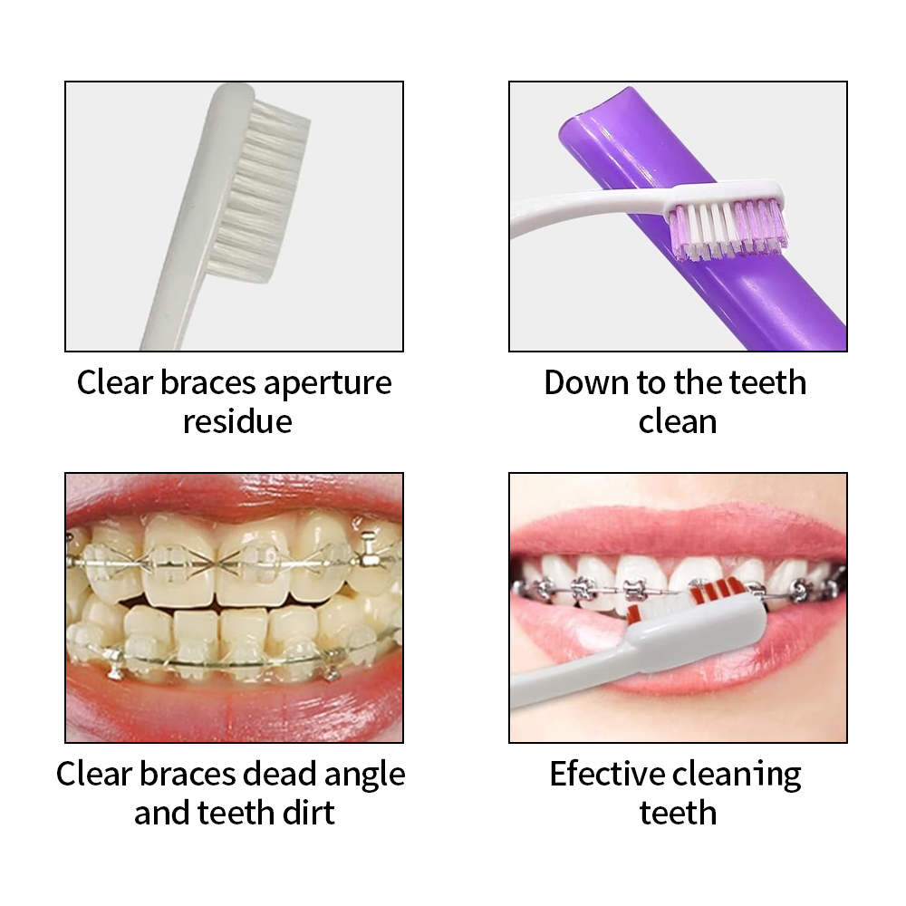 8 ピース/セット矯正歯科ケアブラシキット歯クリーニングブレ - Teeth Whitening With Braces のレビューと価格
