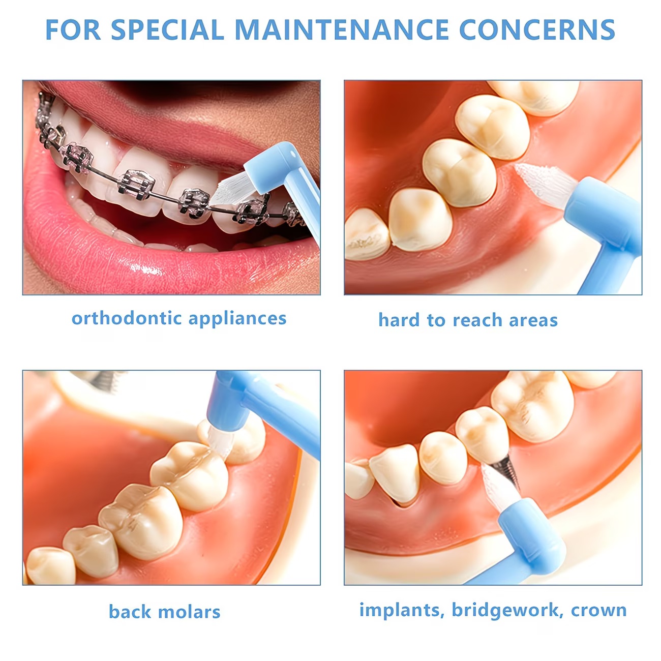 1/3pc 歯科矯正用歯ブラシ シングルタフテッド小型尖頭ヘ - Teeth Whitening With Braces のレビューと価格