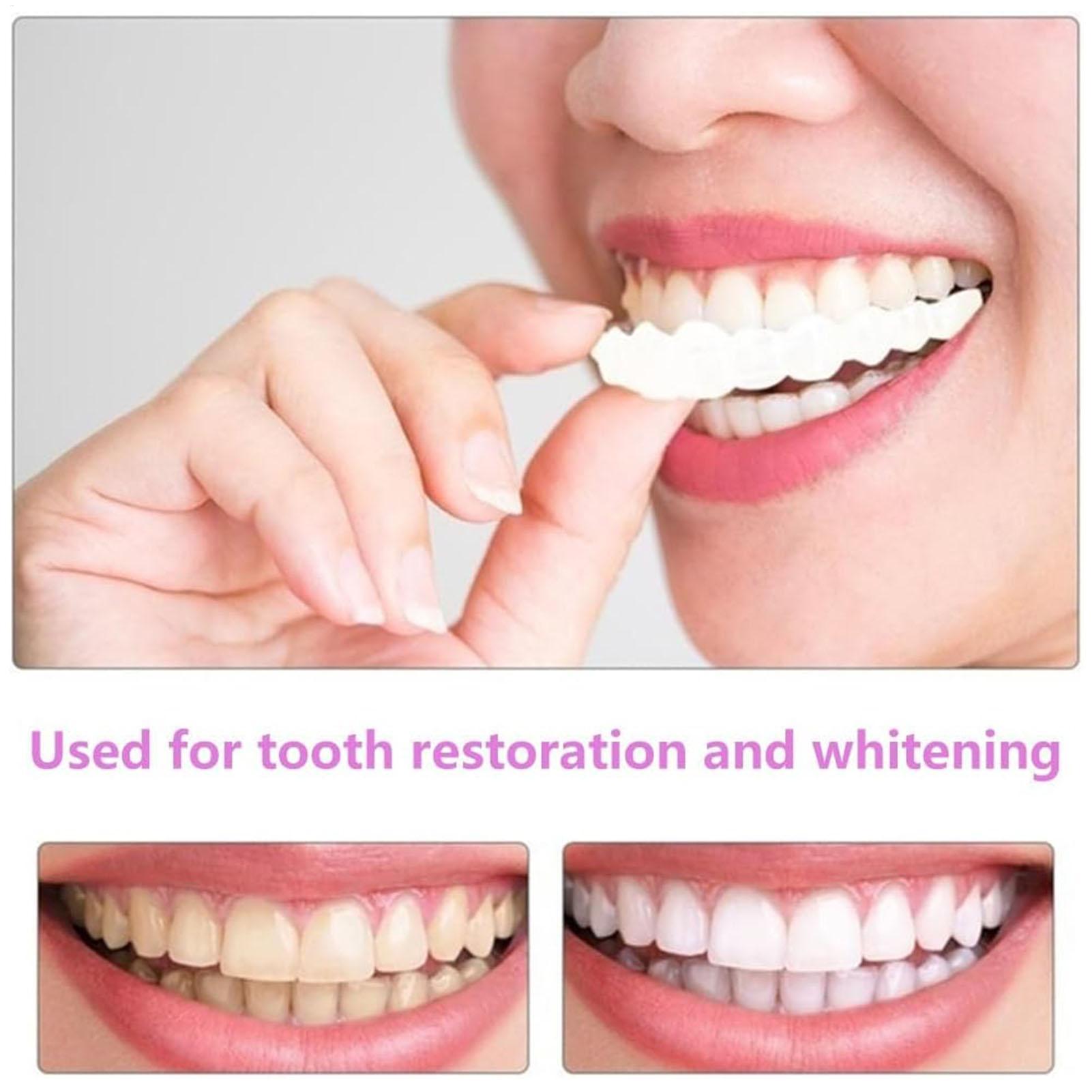 歯科用上下義歯カバー ブライトベニア 快適フィット フレック - Teeth Whitening With Braces のレビューと価格