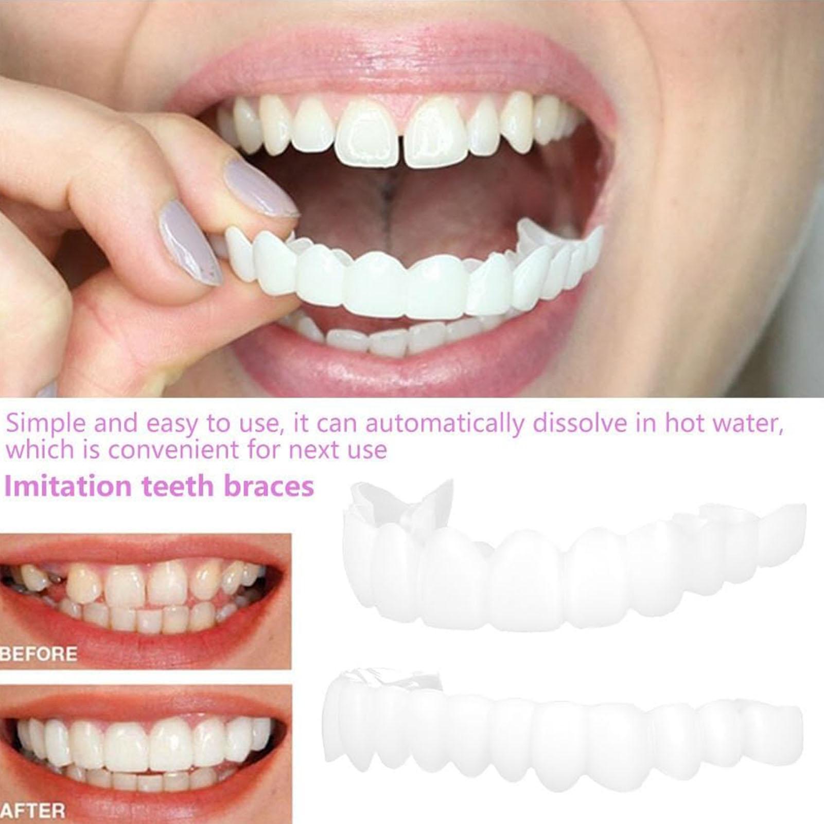 歯科用上下義歯カバー ブライトベニア 快適フィット フレック - Teeth Whitening With Braces のレビューと価格