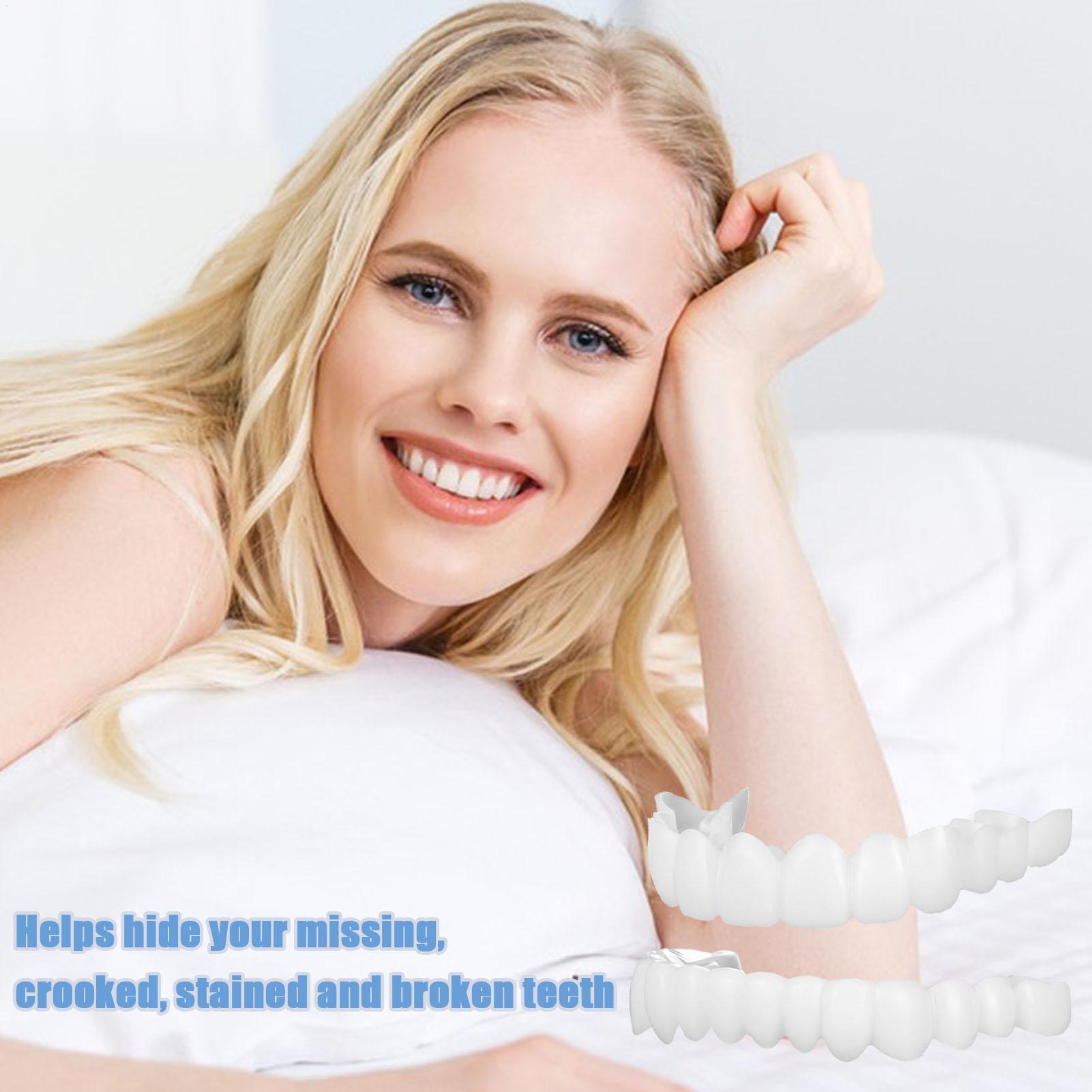 歯科用上下義歯カバー ブライトベニア 快適フィット フレック - Teeth Whitening With Braces のレビューと価格
