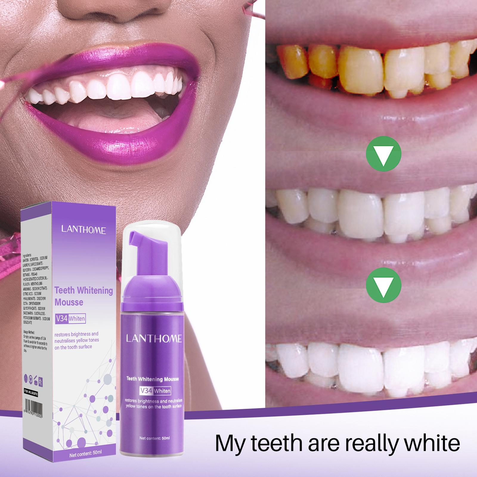 V34 ムース歯クリーニング歯磨き粉効果的な美白歯の除去深い - Teeth Whitening Yellow Teeth のレビューと価格