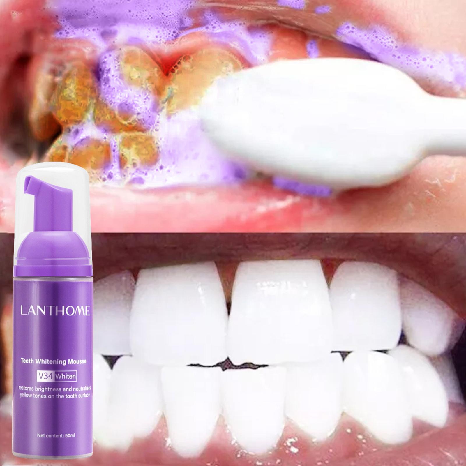 V34 ムース歯クリーニング歯磨き粉効果的な美白歯の除去深い - Teeth Whitening Yellow Teeth のレビューと価格