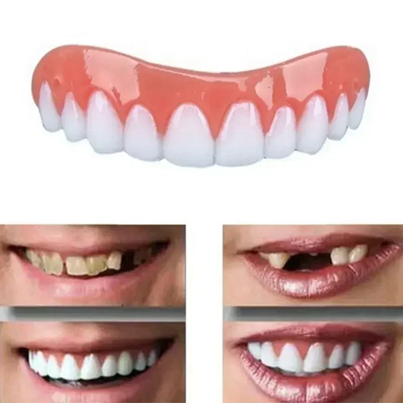 新しいシリコン製義歯 上歯・下歯 ベニア 完璧な笑顔ベニア  - Teeth Whitening With Braces のレビューと価格