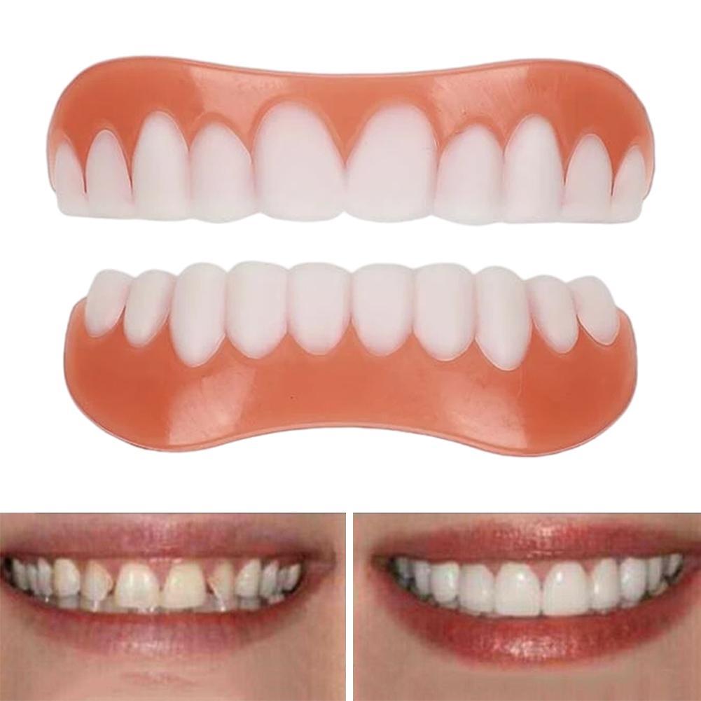 新しいシリコン製義歯 上歯・下歯 ベニア 完璧な笑顔ベニア  - Teeth Whitening With Braces のレビューと価格