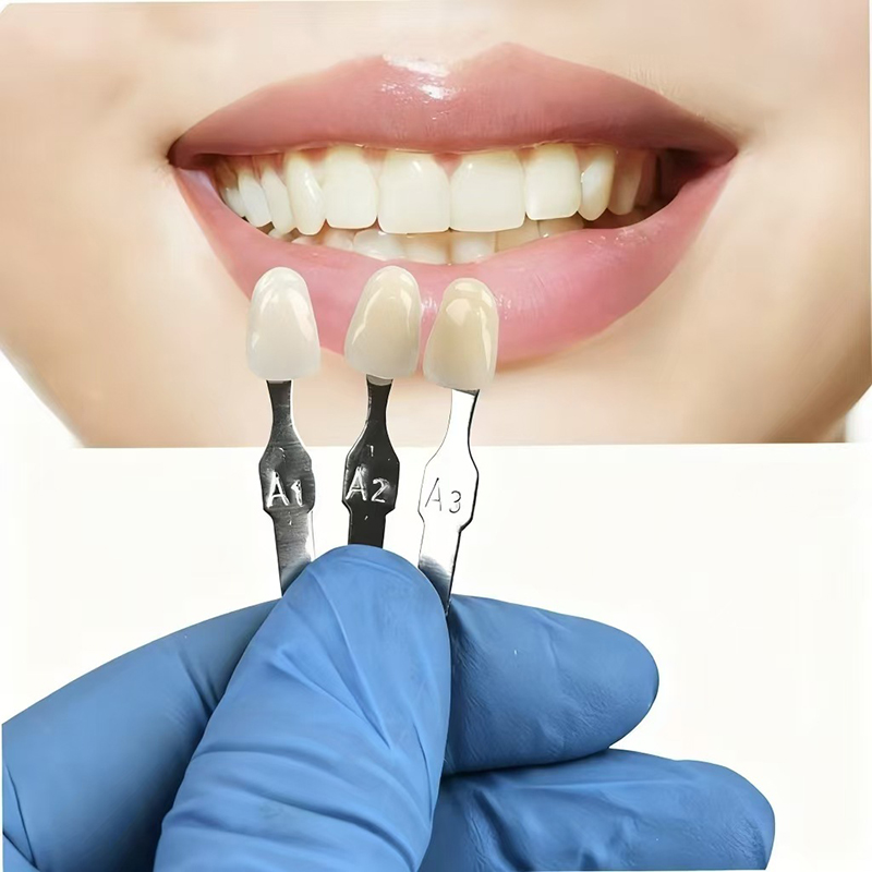VITA 16色歯色ガイド クラシック歯科用歯のホワイトニン - Teeth Whitening Shade Guide のレビューと価格