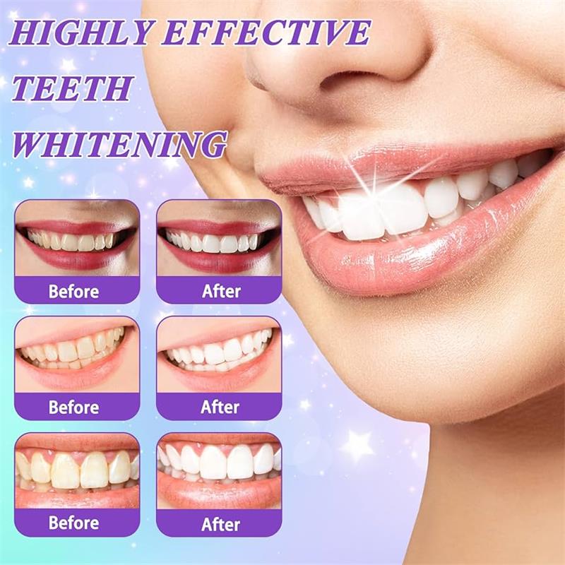9D パープル歯磨き粉ムース 黄ばんだ歯の汚れ除去用集中ステ - Teeth Whitening Yellow Teeth のレビューと価格