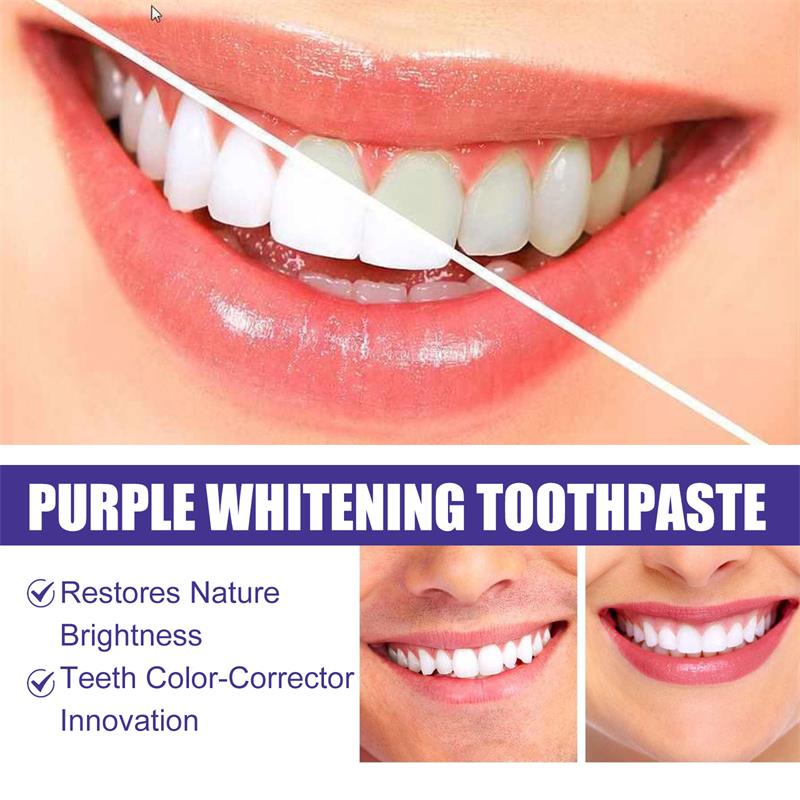 9D パープル歯磨き粉ムース 黄ばんだ歯の汚れ除去用集中ステ - Teeth Whitening Yellow Teeth のレビューと価格