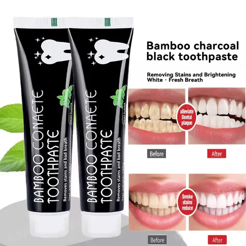 ホワイトニング歯磨き粉 竹炭歯磨き粉 口臭を吸収し、黄色い歯 - Teeth Whitening Yellow Teeth のレビューと価格