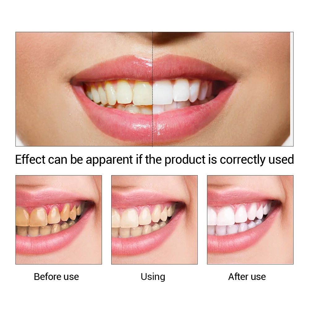 歯のホワイトニングエッセンス,口腔衛生,歯のホワイトニング, - Teeth Whitening Remedies のレビューと価格