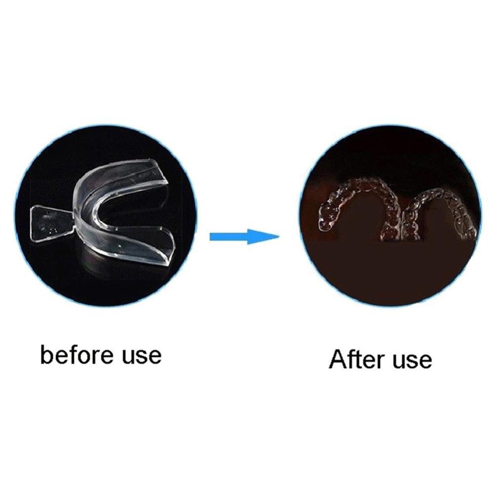 シリコン製マウスガード、歯列矯正用、歯の保持器、歯ぎしり防止 - Teeth Whitening With Braces のレビューと価格