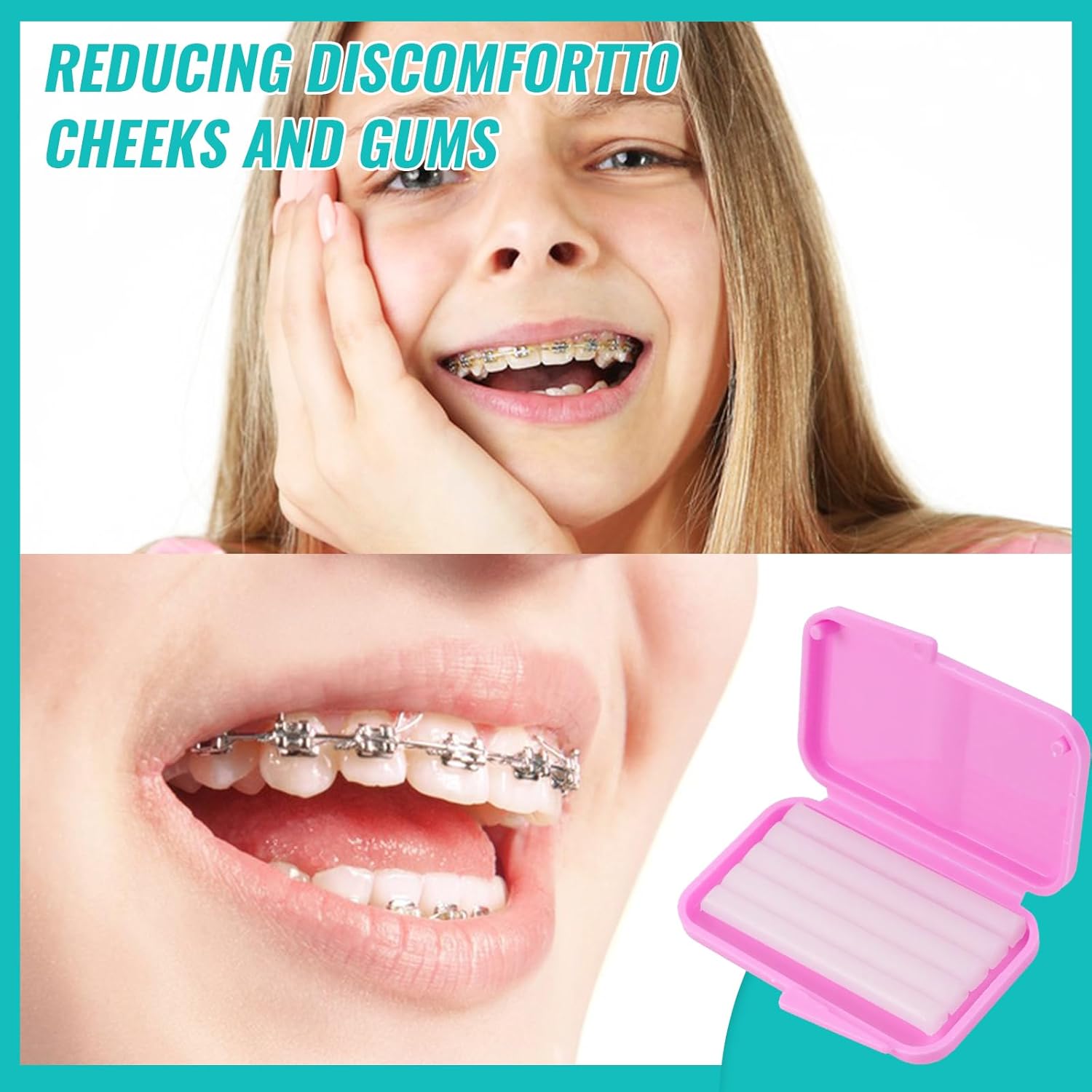 10 ボックス歯科矯正リリーフワックスブレース用歯茎刺激歯の - Teeth Whitening With Braces のレビューと価格