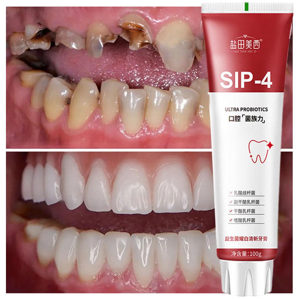 100g Sip-4 プロバイオティクスホワイトニング歯磨き - Teeth Whitening Yellow Teeth のレビューと価格
