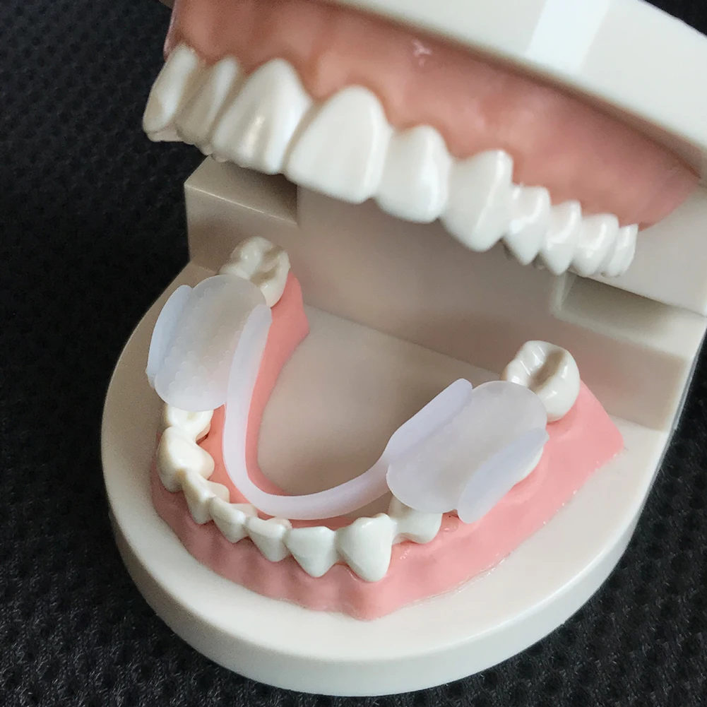2 個の歯の副木プロテクターソフトナイト耐摩耗パッド耐摩耗シ - Dental Guard Night のレビューと価格