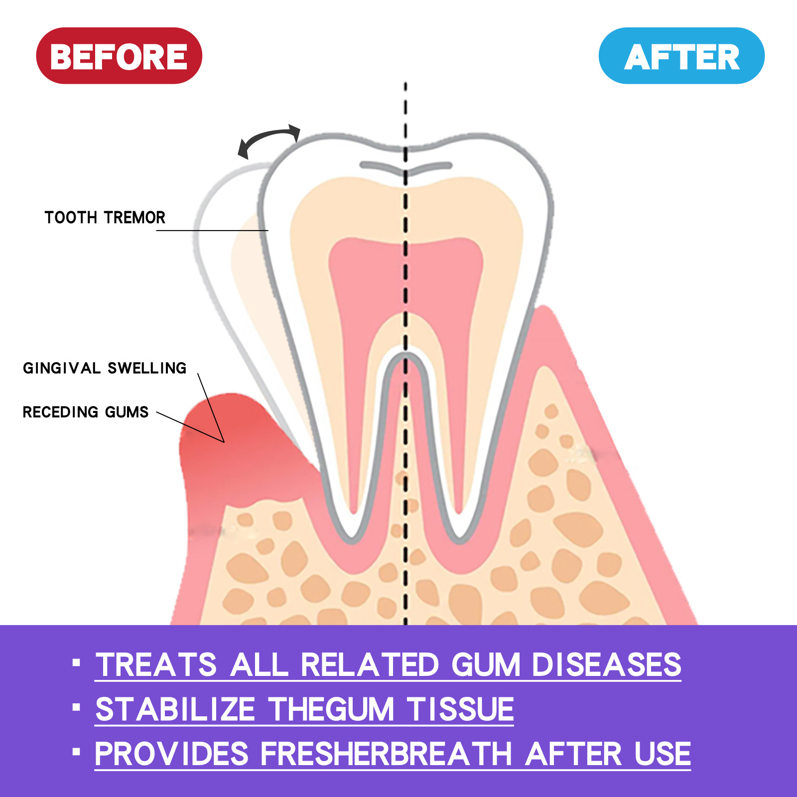 60ml歯のホワイトニングムースV34歯のクリーニングホワイ - Teeth Whitening Yellow Teeth のレビューと価格
