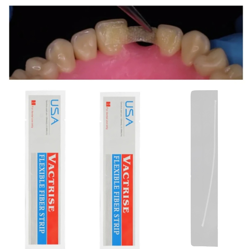 1 個歯科用フレキシブルファイバーストリップガラススプリント - Teeth Whitening Strips Lumineux のレビューと価格