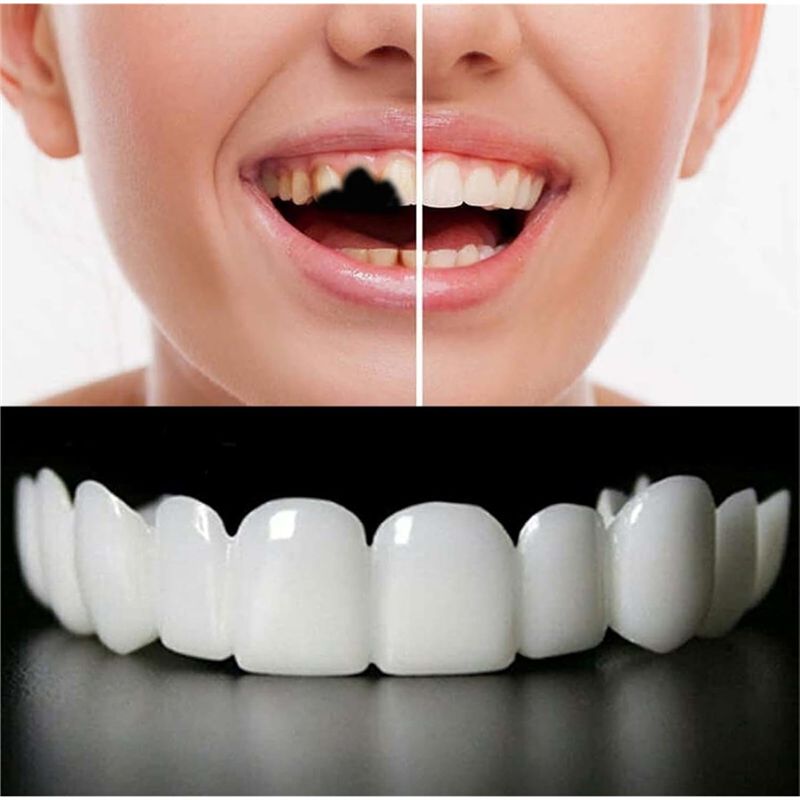 【新商品！ABMK】2ペア、美しい笑顔を取り戻す、ユニバーサ - Teeth Whitening With Braces のレビューと価格