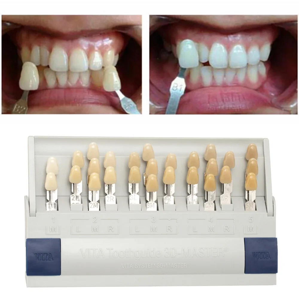 Vita 3D マスター歯科ラボ漂白シェードガイド 29 色 - Teeth Whitening Shade Guide のレビューと価格